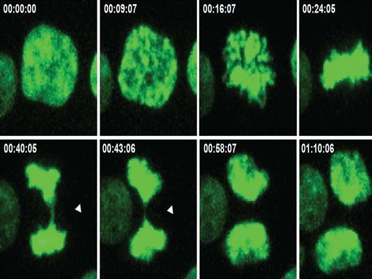 This series of images shows the process of cell division and indicates errors that lead to an imbalance in chromosome number