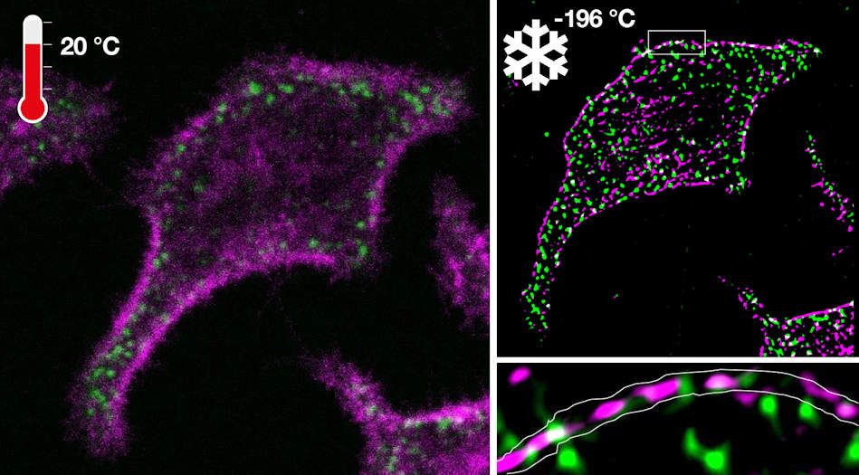 Fluorescence microscopy of an oncoprotein and corresponding tumor suppressor in a living cell before cryoarrest (left) and a super-resolution image obtained under cryoarrest (right).