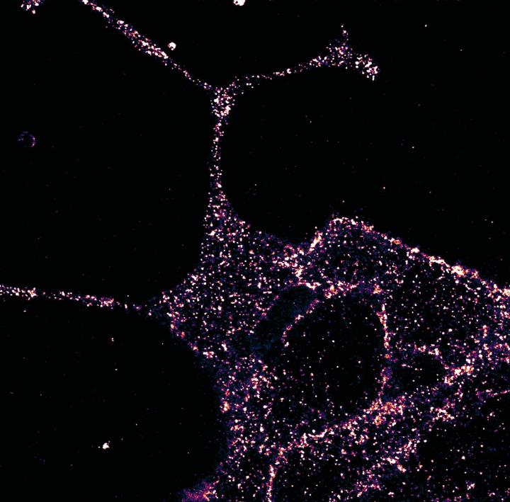 GLP1R visualized in insulin-secreting beta cells at superresolution