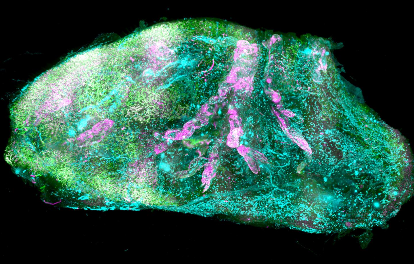 Condensed light traveling end-to-end in a transparent human brain made visible with SHANEL