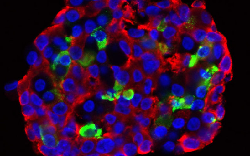 Picture of stem cell-derived pancreatic tissue.