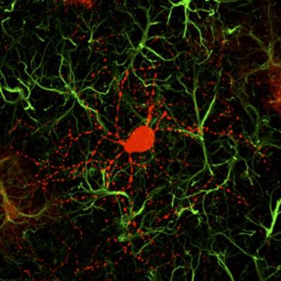 The image shows a newly converted neuron surrounded by astrocytes