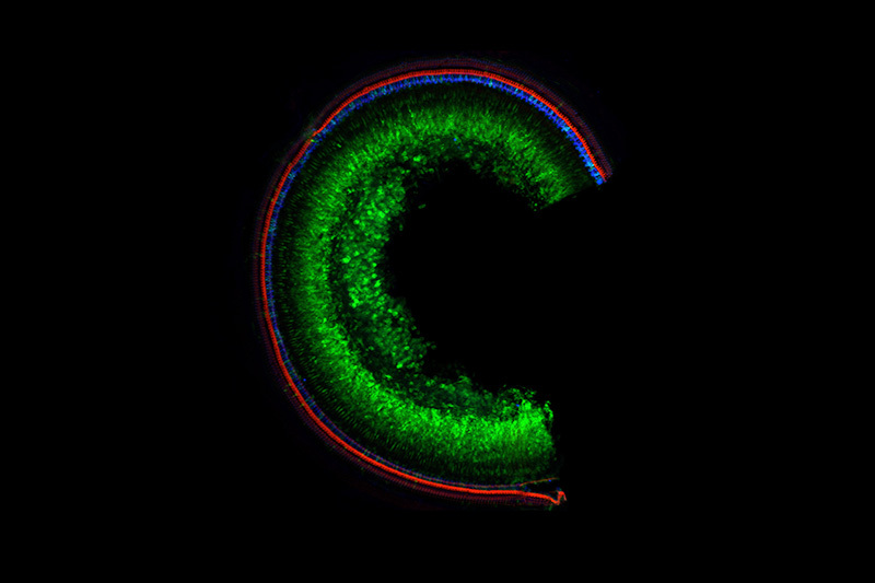 A laser scanning confocal microscope image of the mouse cochlea,