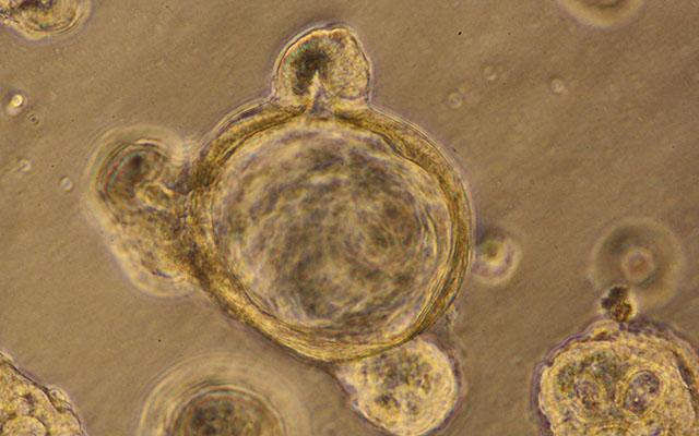 Image of a minigut organoid generated in the lab from human stem cells