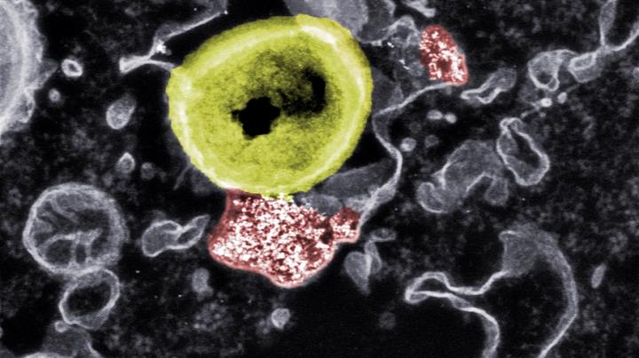 Deadly contact: Researchers at Empa and ETH have developed nanoparticles (red) that can kill resistant bacteria (yellow).
