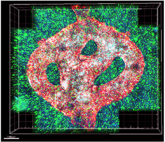 Microscopic image of a 3D bioprinted glioblastoma model.