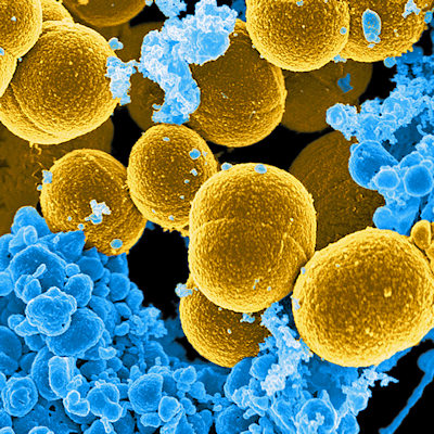 https://www.scienceboard.net/user/images/content_images/sup_can/2023_04_24_17_05_3155_bacteria_staphylococcus_aureus_400.jpg