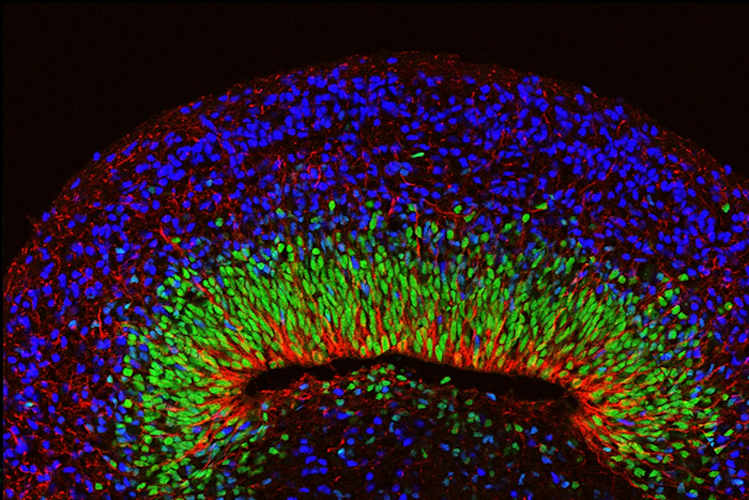 Microscope image of a minibrain organoid showing layered neural tissue and different types of neural cells.