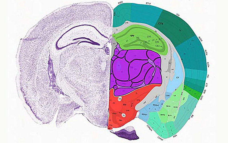 The Mouse Brain Atlas.