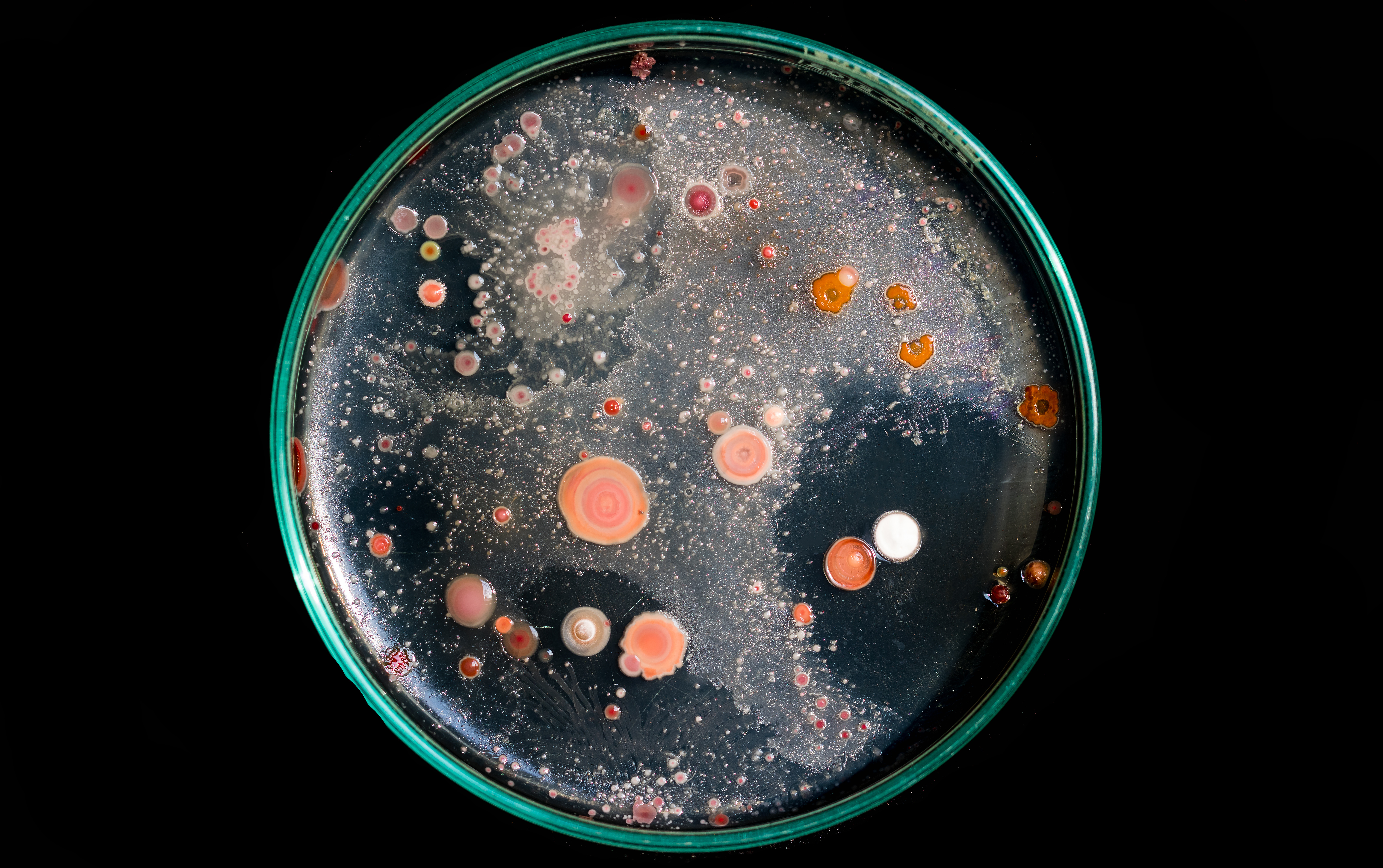 Бактерии домашних условиях. Чашка Петри с бактериями. Микробы в чашке Петри. Клетки в чашке Петри. Колонии бактерий в чашке Петри.